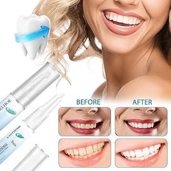 SmilePen Pro™ – Blanquea tus dientes con tecnología profesional, desde casa 🦷✨+ Envio Gratis